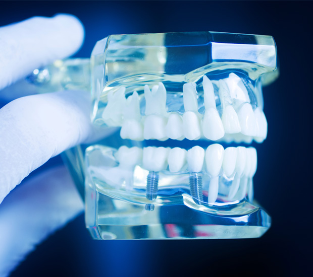 Tucson Dental Implant Restoration