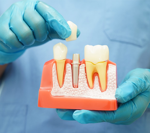 Tucson Questions to Ask at Your Dental Implants Consultation