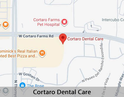 Map image for Options for Replacing Missing Teeth in Tucson, AZ