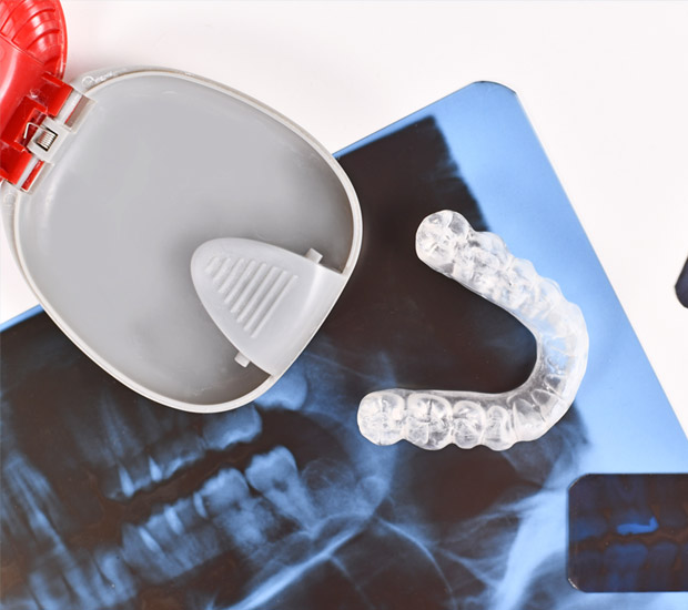 Tucson Mouth Guards